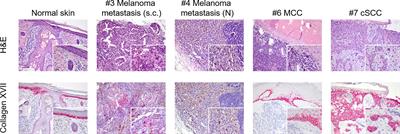 Hemidesmosomal Reactivity and Treatment Recommendations in Immune Checkpoint Inhibitor-Induced Bullous Pemphigoid—A Retrospective, Monocentric Study